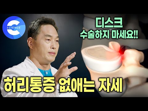 자세 교정으로 좋아지는 허리통증 | 디스크 손상시키는 원인 3가지 | 정선근 교수의 수술없이 허리통증 치료하는 법 | 명의
