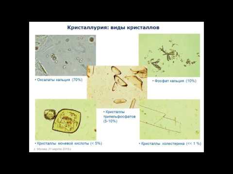 Кристаллурия в диагностике заболеваний почек