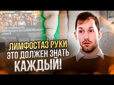 ЛИМФОСТАЗ РУКИ - это должен знать каждый!