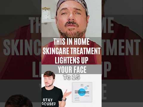 INSANE! Makes Skin Look 10 Years Younger In 15 MINUTES!!!