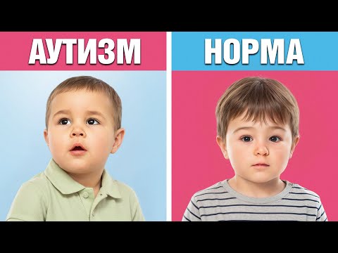 РОДИТЕЛИ, не упустите! 10 Едва заметных признаков аутизма