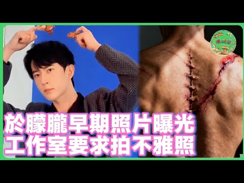 於朦朧早期照片曝光！工作室曾和資本聯合逼壓，要求其拍不雅照！|  #於朦朧 #范世錡 #追光吧哥哥 #于朦胧 #杨幂  #娱乐圈   #金星 #易烊千玺