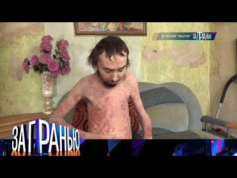 За гранью 2025 | «37 летний 'маугли»  Full HD