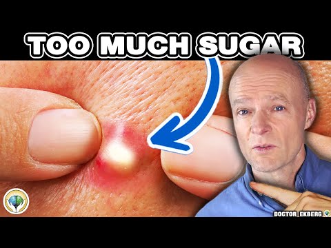 10 Signs You're Eating Too Much Sugar