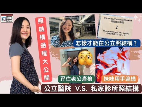 【珊B要考牌 #69】公立醫院 V.S 私家診所照結構💁🏻‍♀️！｜怎樣才能在公立照結構🤔？｜妹妹👶🏼照結構過程大公開👀｜Fetal Morphology Scan