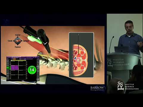 History and Future of Lateral Surgery - Juan S. Uribe, MD, FAANS