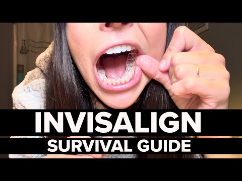 How To Prepare & What To Expect With INVISALIGN