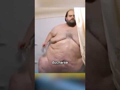 Asi es Vivir Pesando 362 kg