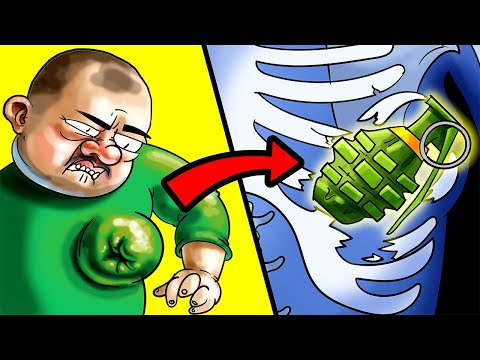 Craziest Things Ever Found In The Human Body