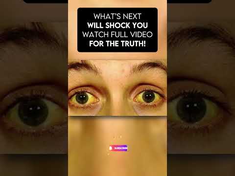 The Truth Behind Johnny Depp’s Sudden Disappearance part 2