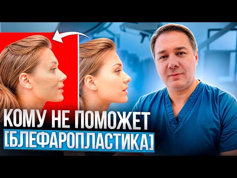 Пора делать или надо подождать? [Блефаропластика] Подтяжка верхних и нижних век