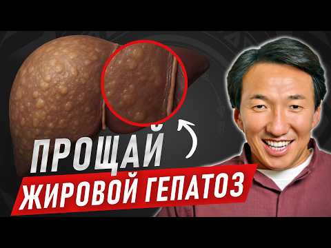 FATTY HEPATOSIS: How to save your LIVER? #doctorzimba