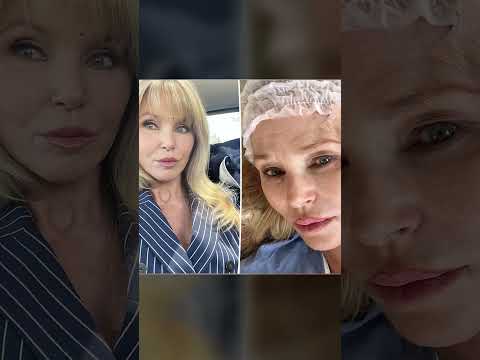 25 Famous Actors Nearing Death from Cancer Then and Now 2025