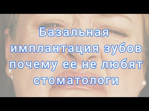 БАЗАЛЬНАЯ имплантация зубов.