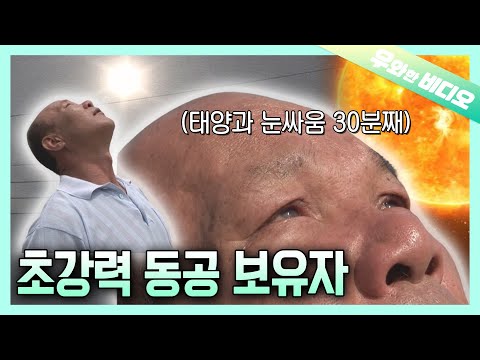 태양을 맨눈으로 30분 동안 바라보면 생기는 일┃What Happens When You Stare at the Sun for 30 Minutes