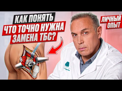 Не соглашайся НА ЭНДОПРОТЕЗИРОВАНИЕ до ЭТОГО ВОЗРАСТА – Когда соглашаться на замену сустава?