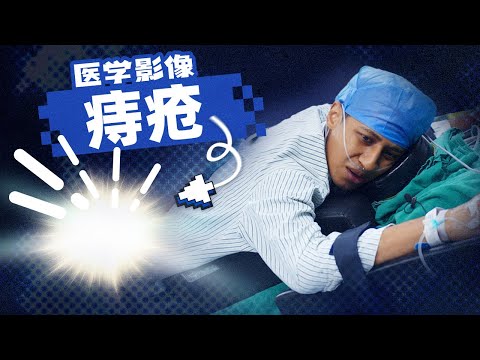 How Big Can Hemorrhoids Be? We Shot a Colleague’s Surgery!