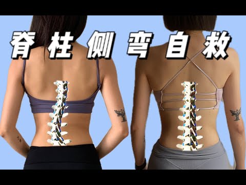 我用开龙脊练好了脊柱侧弯!长短腿高低肩大小脸同时解决！