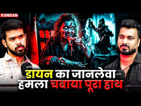 डायन का जानलेवा हमला चबाया पूरा हाथ 😱| Ft. Kundan | Real Horror Incidents #horror