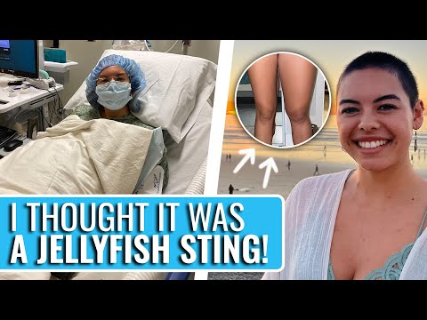 My Health Had Been Declining For MONTHS! | McKenna's Patient Story