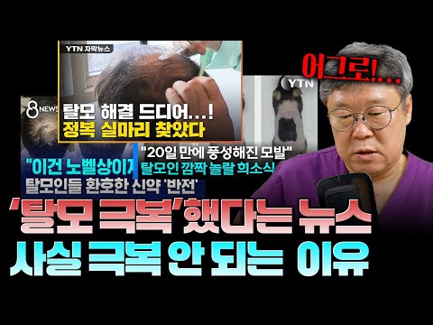 탈모치료 수십년한 의사가 탈모극복 뉴스 안 믿는 이유ㅣ제발 속지 마세요