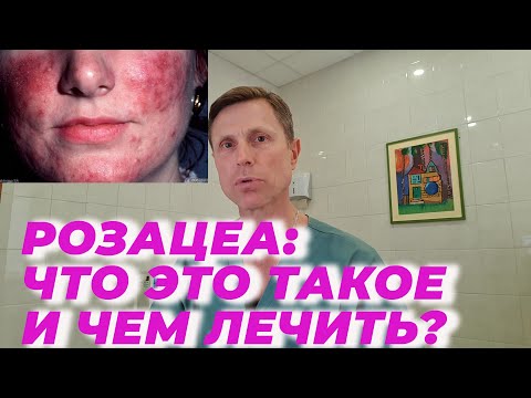 Rosacea: what it is and how to treat it.