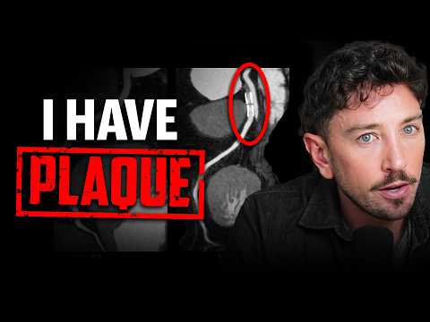 Do I Have Heart Disease? My Heart Scan Results | Dr Thomas Dayspring and Dr Dan Soffer | EP #372