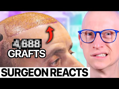 Why Istanbul Is The Place to Get Your Hair Back | Surgeon Reacts