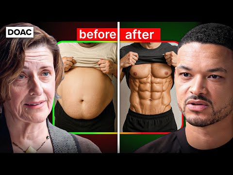 Doctor's EASIEST Way To Lose Fat WITHOUT Exercise