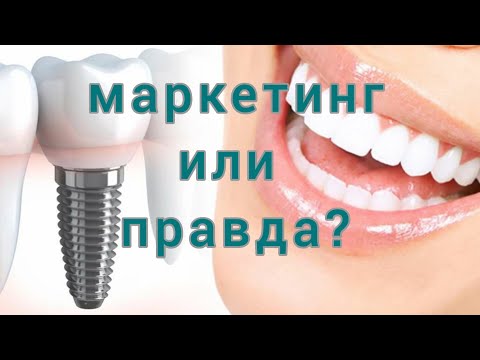 МГНОВЕННАЯ имплантация зубов. Быстрая ИМПЛАНТАЦИЯ зубов.