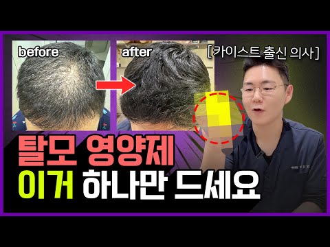 탈모 약 대신 '이걸' 먹으면 머리 숱이 풍성해진다!?