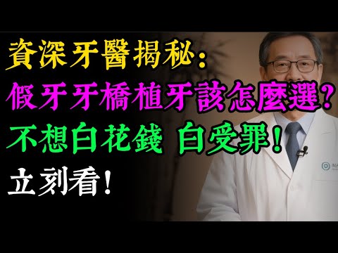 缺牙了怎麼辦？活動假牙、牙橋、植牙，到底怎麼選？牙醫沒說的「天大區別」，一次說清楚！#健康知识#老年健康#健康养生#健康之眼