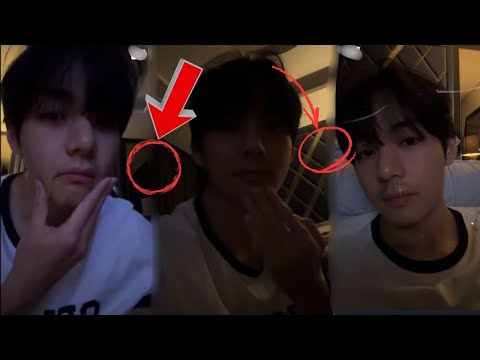 OMG 😱 Taehyung Ends Live Abruptly — Jungkook APPEARS SUDDENLY?!
