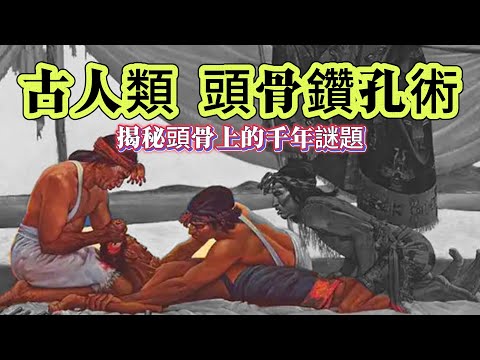 【迷霧-探索未解之謎】| 古人類頭骨鑽孔術！揭秘骨頭上的千年謎題！#未解之謎 #探秘 #獵奇 #科普