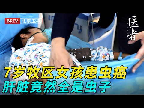7岁牧区女孩患虫癌,肝脏竟然全是虫子,医生切开吓了一跳【医者】