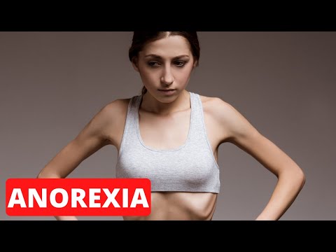 La ANOREXIA explicada: síntomas, causas, tipos, tratamientos, prevención