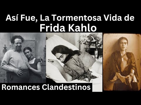 Así fue, la Tormentosa Vida de  Frida Kahlo | Lo que nunca te Contaron