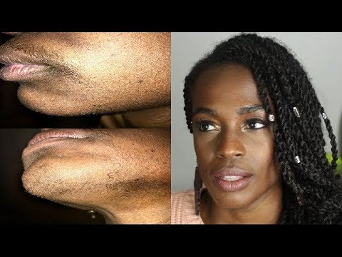 Finishing Touch Flawless Hair Remover 1 month update- This product is THRASSHHH🗑️🗑️🗑️