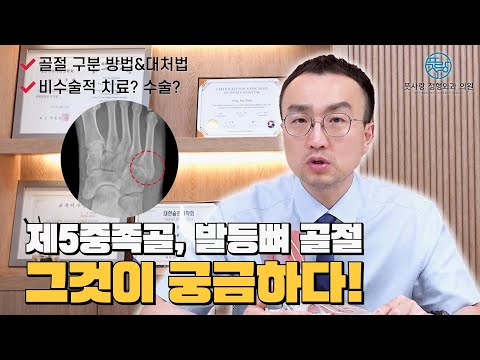제 5 중족골 골절에 대한 모든것 (수술이 필요한 경우) #부산발등중족골골절 #부산족부 #제5중족골골절