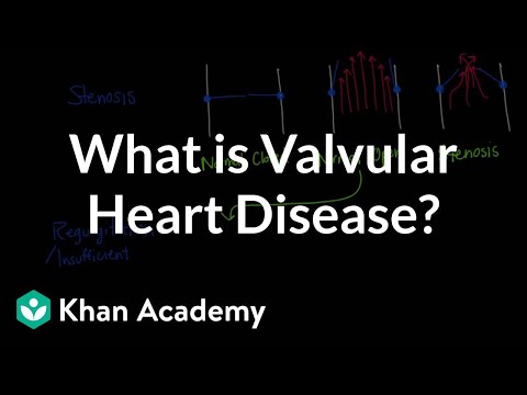 What is valvular heart disease? | Circulatory System and Disease | NCLEX-RN | Khan Academy