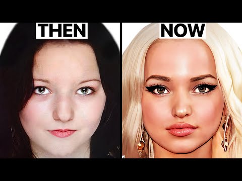 Dove Cameron's NEW FACE | Plastic Surgery Analysis
