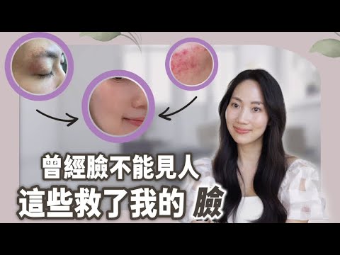 擦什麼都沒用😥 用這些皮膚才救回來@DrGrace