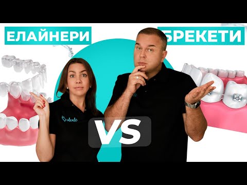 ЕЛАЙНЕРИ VS БРЕКЕТИ! Що краще обрати?