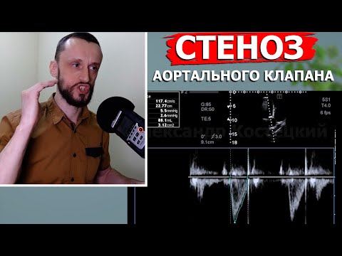 Determining the degree of aortic valve stenosis | Calculating the area