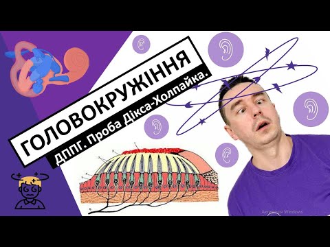 ГОЛОВОКРУЖІННЯ та запаморочення. ДППГ. Проба Дікса-Холпайка. Маневр Еплі. #головокружіння