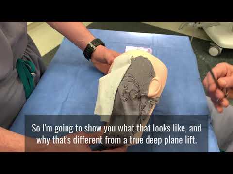 Deep Plane Facelift Demonstration & Explanation (Nongraphic)