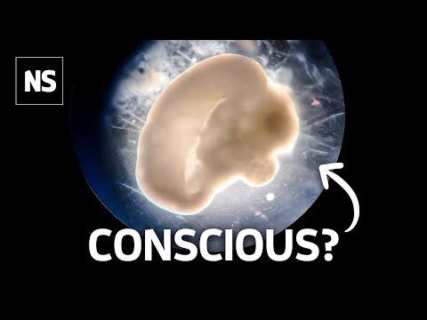 Brain Organoids Are Unlocking the Secrets of the Human Mind