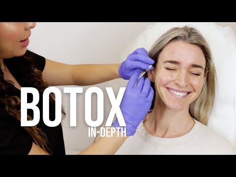 BOTOX | IN-DEPTH