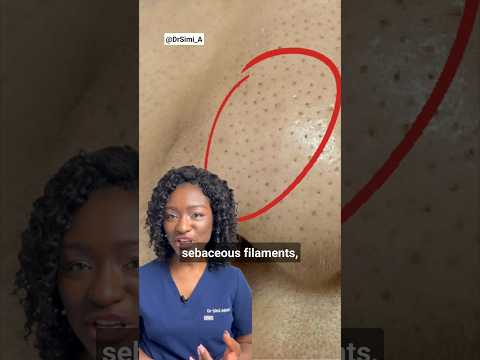 Black Dots on the Nose? Sebaceous Filaments & How To Get Rid Of Them + Products