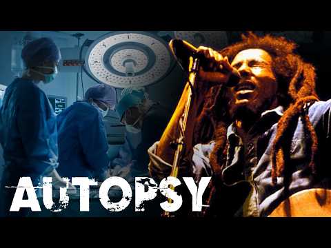 What Really Caused Bob Marley's Death? | Our History